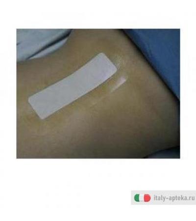 Tegaderm Cer+pad 6x10cm 5pz